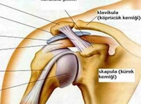 Kas Sıkışması Belirtileri ve Tedavisi Kas Sıkışması Belirtileri ve Tedavisi