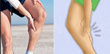 Kas Zedelenmesi Belirtileri ve Tedavisi Kas Zedelenmesi Belirtileri ve Tedavisi